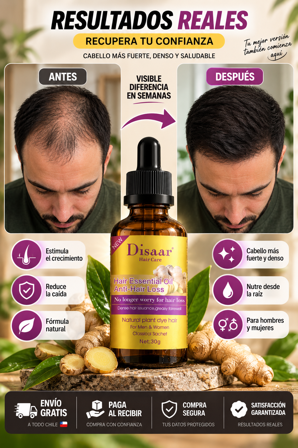 Aceite Anticaida Hair Jengibre Serum